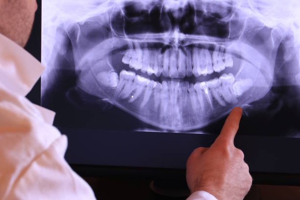 Urgent Tooth Repair in NC